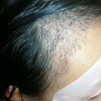 發(fā)際線用戶圖片