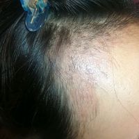 發(fā)際線用戶圖片