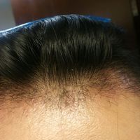發(fā)際線用戶圖片