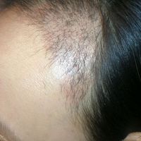 發(fā)際線用戶圖片