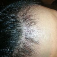 發(fā)際線用戶圖片