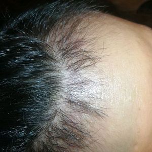 发际线分享社区