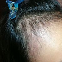 發(fā)際線用戶圖片
