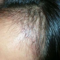 發(fā)際線用戶圖片