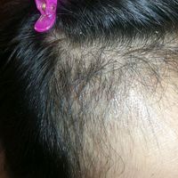 發(fā)際線用戶圖片