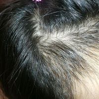 發(fā)際線用戶圖片