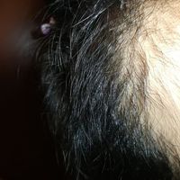發(fā)際線用戶圖片