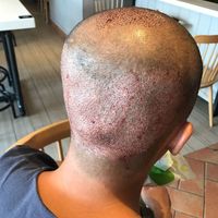 禿頂用戶圖片