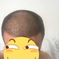 發(fā)際線用戶圖片