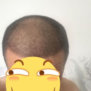 发际线分享社区