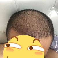發(fā)際線用戶圖片