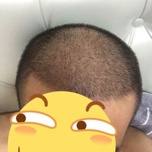 发际线分享社区