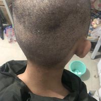 發(fā)際線用戶圖片