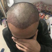 發(fā)際線用戶圖片