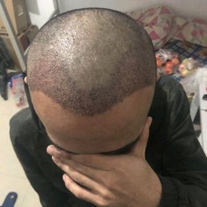 发际线分享社区