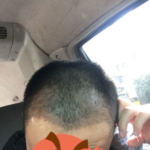 发际线分享社区