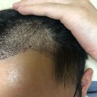 發(fā)際線用戶圖片