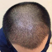 發(fā)際線用戶圖片