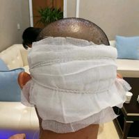 禿頂用戶圖片