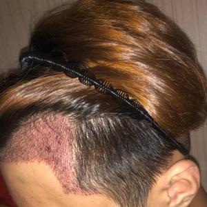 发际线分享社区