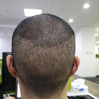 發(fā)際線用戶圖片