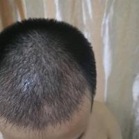 發(fā)際線用戶圖片