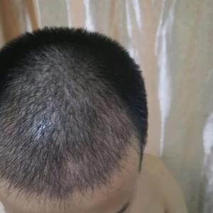 发际线分享社区