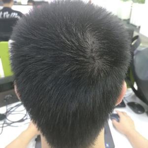 发际线分享社区