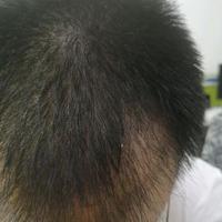 發(fā)際線用戶圖片