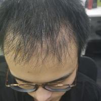 發(fā)際線用戶圖片