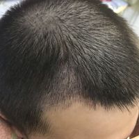 發(fā)際線用戶圖片