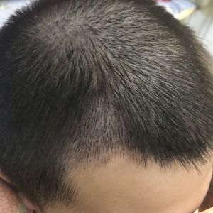 发际线分享社区