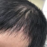 發(fā)際線用戶圖片