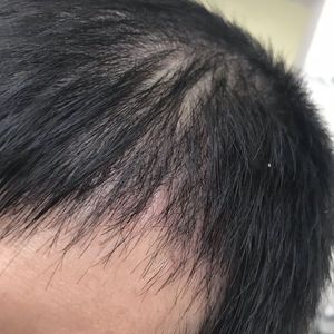 发际线分享社区