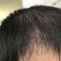 發(fā)際線用戶圖片
