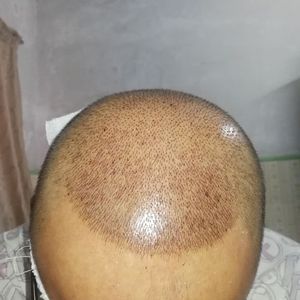 发际线分享社区