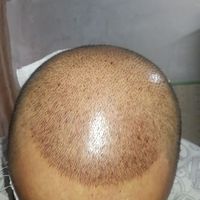 發(fā)際線用戶圖片