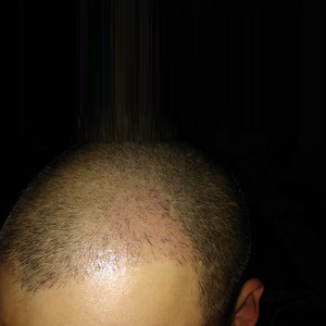 发际线分享社区