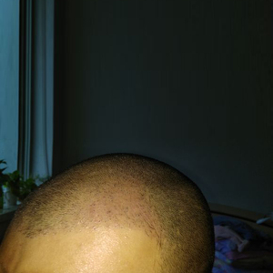 发际线分享社区
