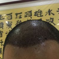 發(fā)際線用戶圖片