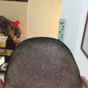 发际线分享社区