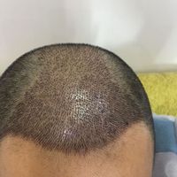 發(fā)際線用戶圖片