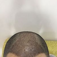 發(fā)際線用戶圖片