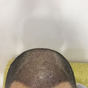 发际线分享社区