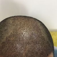 發(fā)際線用戶圖片