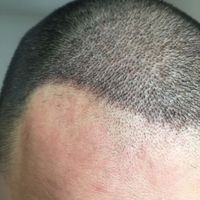 發(fā)際線用戶圖片