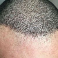 發(fā)際線用戶圖片