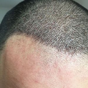发际线分享社区