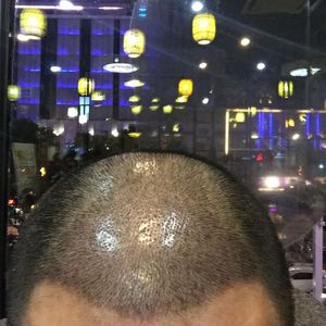 发际线分享社区