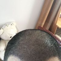 發(fā)際線用戶圖片